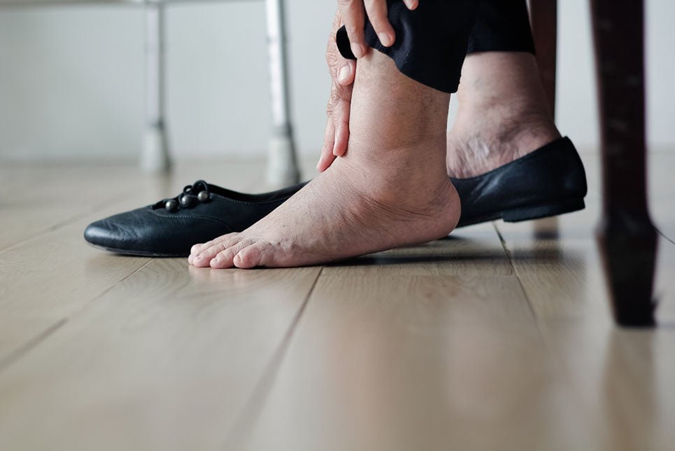 an elderly woman with swollen feet taking off her shoes